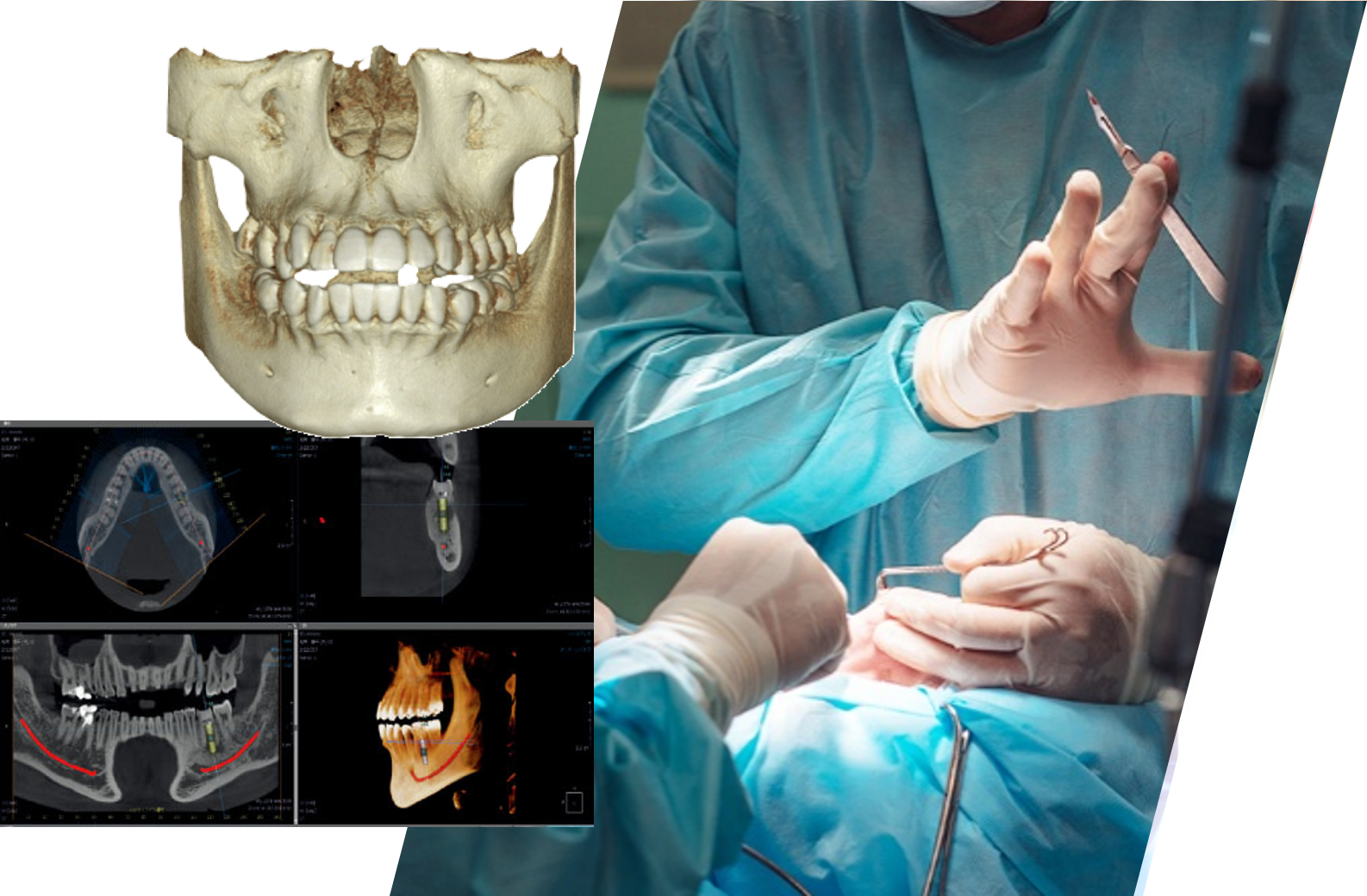 武蔵小杉ネゴ歯科矯正歯科の口腔外科