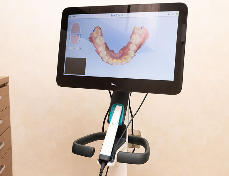  武蔵小杉ネゴ歯科矯正歯科の口腔内スキャナー