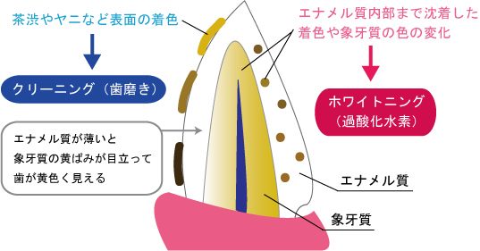 武蔵小杉の歯医者、武蔵小杉ネゴ歯科矯正歯科のホワイトニング