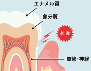 武蔵小杉の歯医者、武蔵小杉ネゴ歯科矯正歯科で歯の痛みについての解説