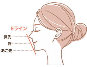 武蔵小杉ネゴ歯科矯正歯科で口ゴボについて解説