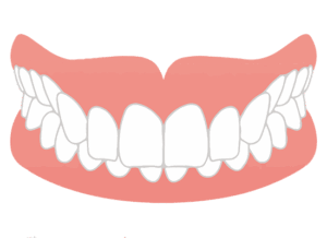 武蔵小杉の歯医者、武蔵小杉ネゴ歯科矯正歯科でハーフリンガル矯正って何？特徴やメリット・デメリットを解説