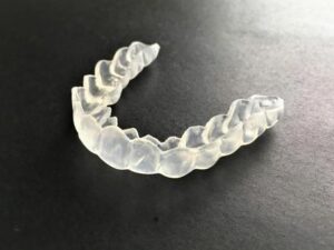 武蔵小杉の歯医者、武蔵小杉ネゴ歯科矯正歯科で歯髄壊死が進むと歯の色が変化する理由と内部吸収の進行について