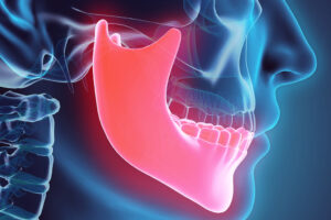 武蔵小杉の歯医者、武蔵小杉ネゴ歯科矯正歯科で歯科治療後に口が開けづらくなった？開口障害の原因と改善方法について