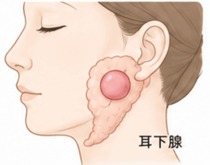 武蔵小杉の歯医者、武蔵小杉ネゴ歯科矯正歯科で、唾液腺腫瘍とは？種類や症状、治療法、予防法を解説